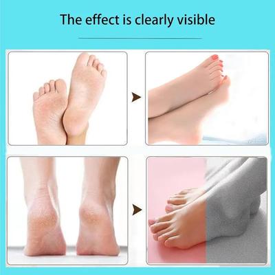 Electric Foot Callus Remover Pink